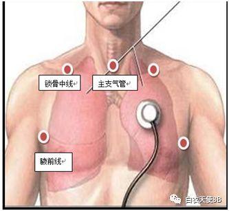 成人肺部吸痰视频教程